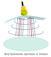 Ультразвуковое сканирование с использованием технологии multi-beam (мульти-луч)