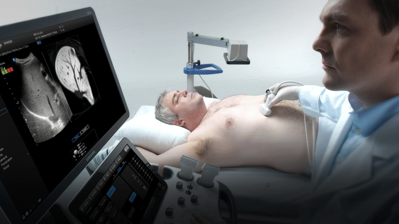 S-Fusion - настройка положения ультразвукового датчика и его ориентации в пространстве относительно тела пациента
