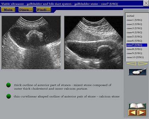 Обучение узи ultrasonicthyroid ru