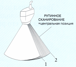 Схема объемного сканирования