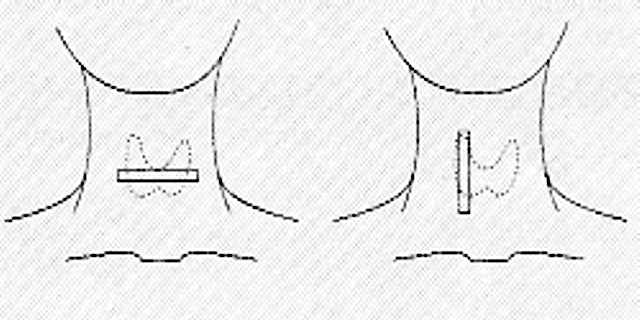 Положение датчика для определения размеров щитовидной железы в поперечной и продольной проекциях