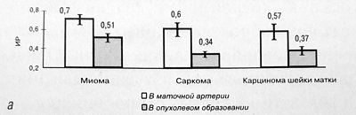 Диаграмма: индекс резистентности (ИР) в маточной артерии и внутриопухолевом образовании при миоме, саркоме и карциноме шейки матки