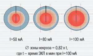 Распределение зон патоморфоза при различных режимах электрохимического лизиса