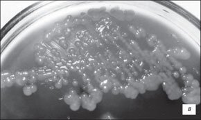 Микробиологическая картина фазы секвестрации острого панкреатита