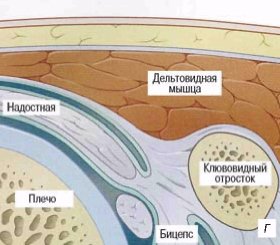 Схема исследования надостной, подостной и двуглавой мышц