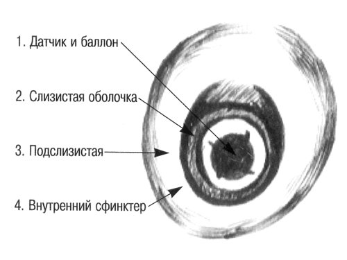 Схема - анальный сфинктер