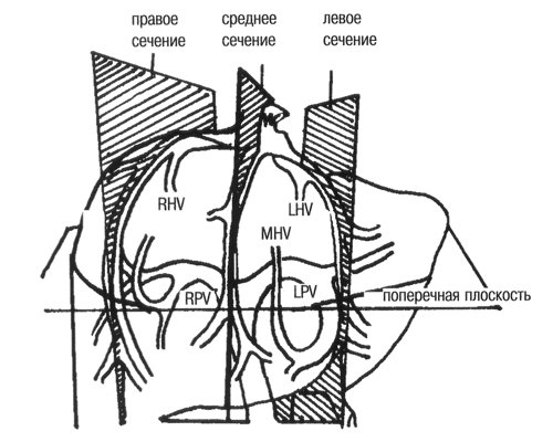 Схема расположения вен печени