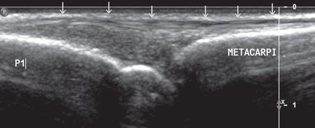 Продольная сонограмма разгибателя III пальца кисти