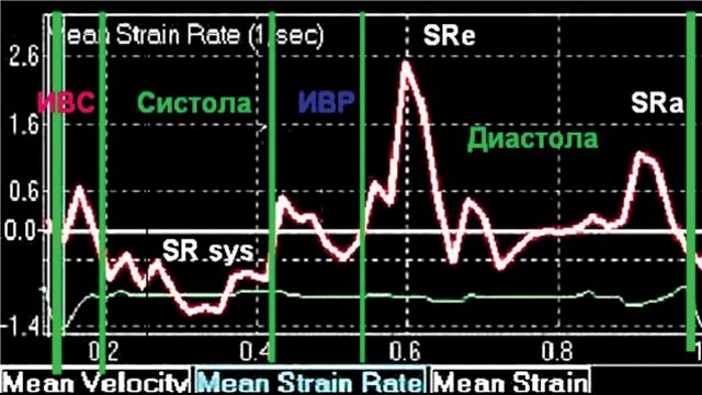 График средней скорости деформации миокарда  (mean strain rate) сегментов МЖП в норме