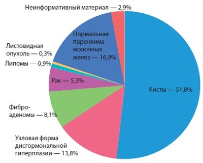 Диаграмма - результаты цитологического исследования очаговых образований молочных желез