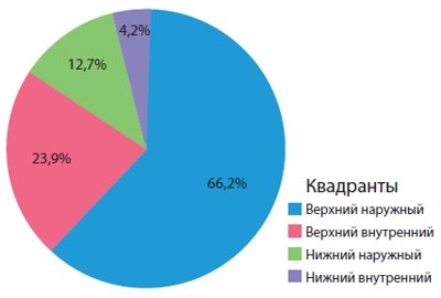 Диаграмма - локализация рака молочной железы