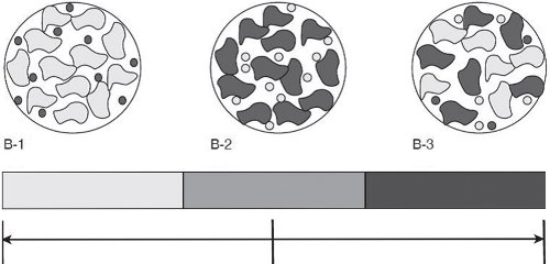 Эластография в режиме ARFI - варианты эластограмм жесткости опухолевой ткани в печени