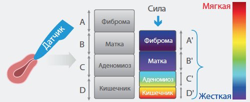 Схематическая диаграмма применения ультразвуковой эластографии в реальном времени