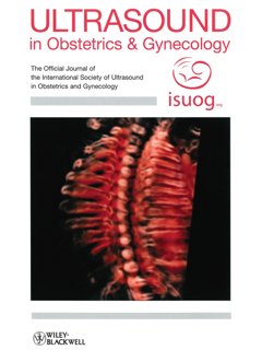 Crystal Vue в журнале Ultrasound in Obstetrics & Gynecology (март 2016)