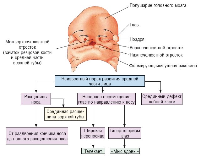 Патогенез синдрома фронтоназальной дисплазии (ФНД)