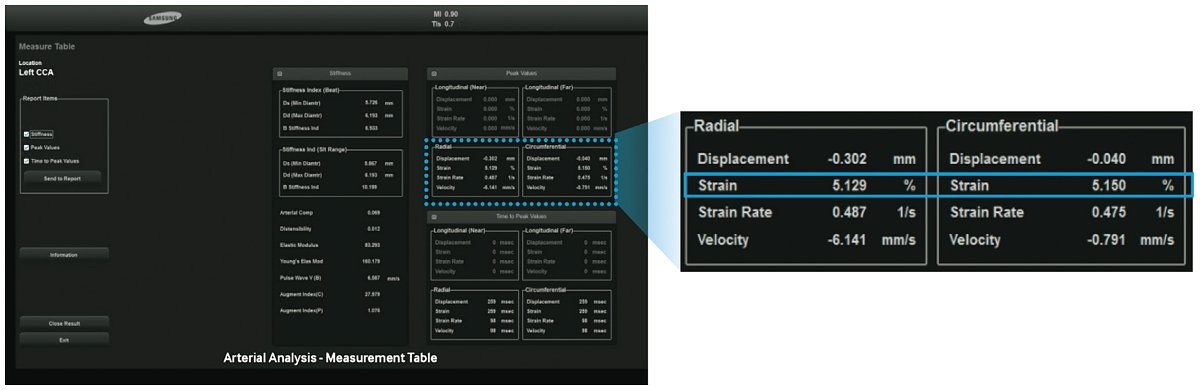 Arterial Analysis - фрагмент работы программы