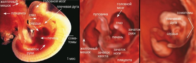 Соноэмбриология: сравнение данных УЗИ и человеческого эмбриона на 7-й неделе гестации