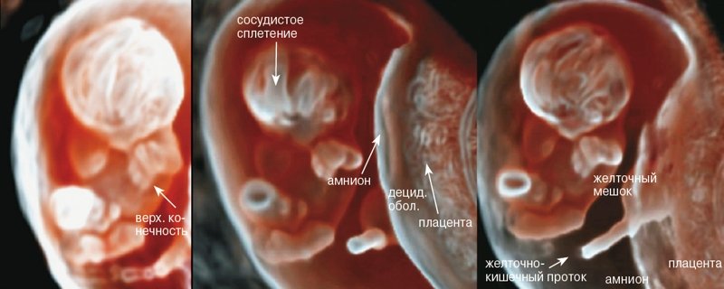CrystalVue - соноэмбриология: придатки эмбриона и хрящевые структуры в пределах зон формирования конечностей (8 недель беременности)