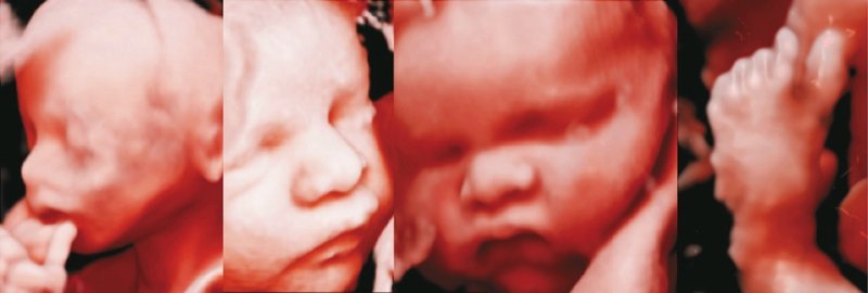 RealisticVue - реконструкция лица и стопы плода (II и III триместры беременности)