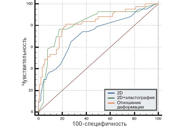 ROC-кривая для 2D УЗИ молочной железы и различных методов оценки эластичности ткани