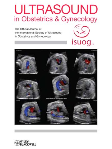 5D Heart Color на обложке журнала Ultrasound in Obstetrics & Gynecology (октябрь 2017)
