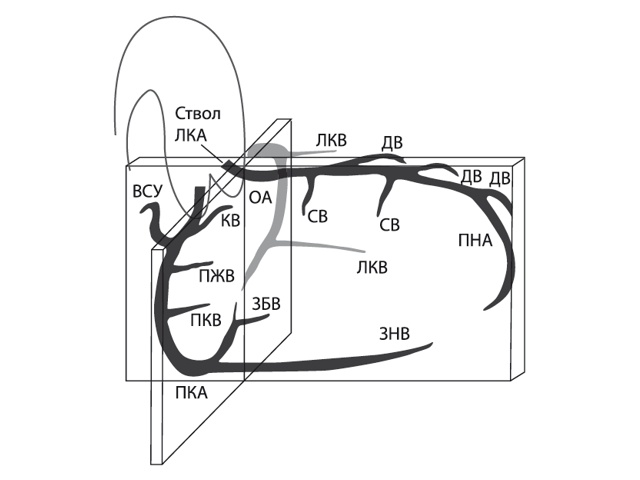 Схема сегментарного деления коронарных артерий