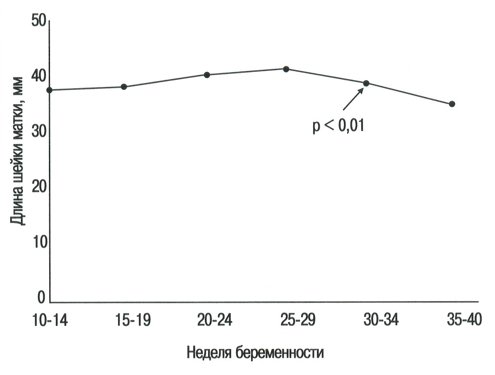 Номограмма - длина шейки матки в течение нормальной беременности