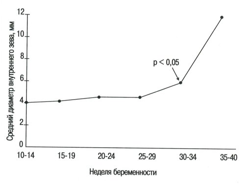 Номограмма - диаметр внутреннего зева в течение нормальной бенности