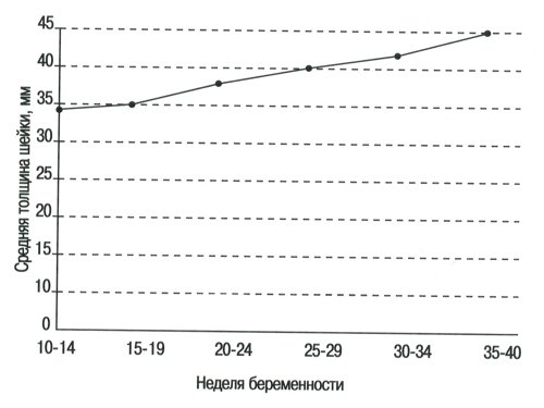 Номограмма - толщина шейки матки в течение нормальной беременности