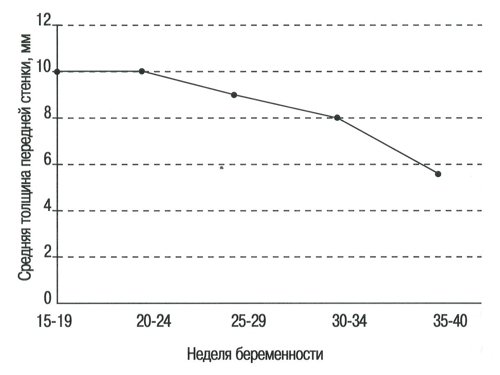 Номограмма - толщина передней стенки нижнего сегмента матки в течение нормальной беременности