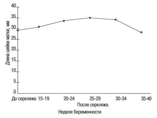 Диаметр внутреннего зева норма при беременности thumbnail