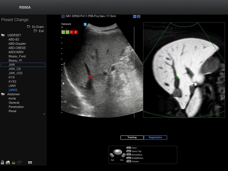 Liver, S-Fusion (echogramm №698)