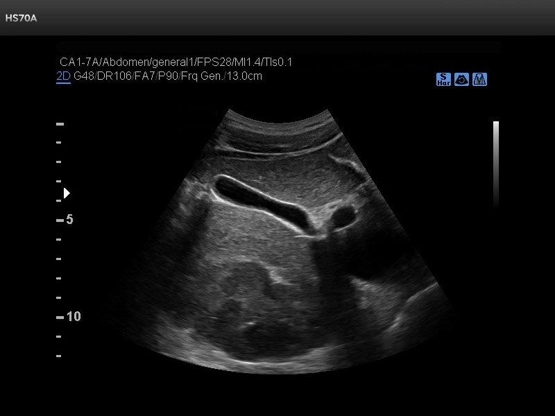 Liver, S-Harmonic (echogramm №713)