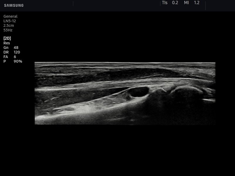 Forearm, B-mode (echogramm №818)