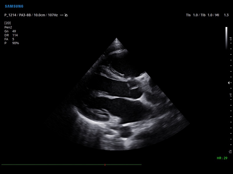 Pediatric echocardiography (echogramm №873)