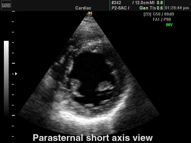 Heart (short axis of LV), B-mode (echogramm №172)