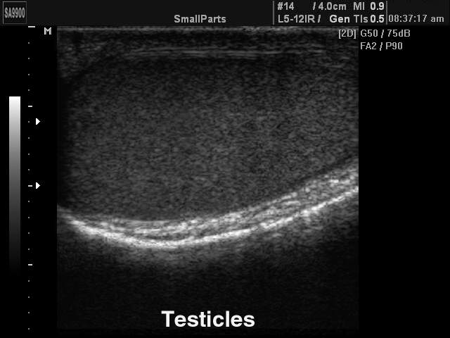 Testicle, B-mode (echogramm №222)