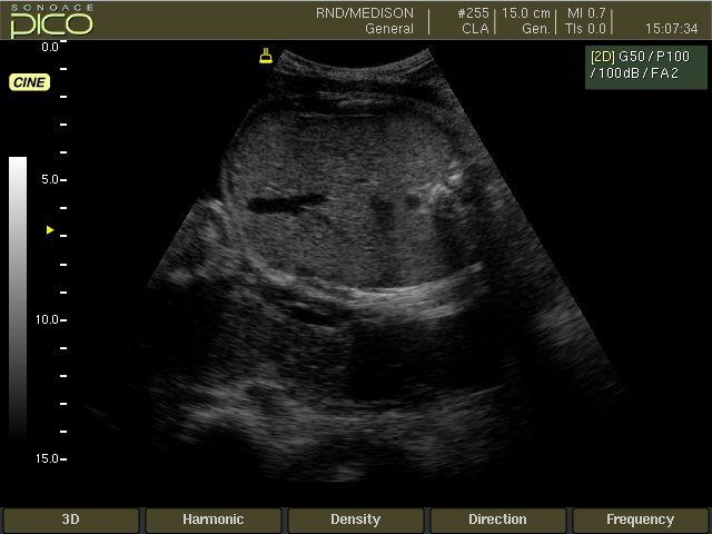 Fetal abdomen, B-mode (echogramm №258)