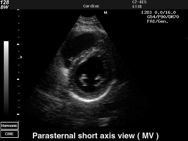 Heart (short axis of LV), B-mode (echogramm №32)