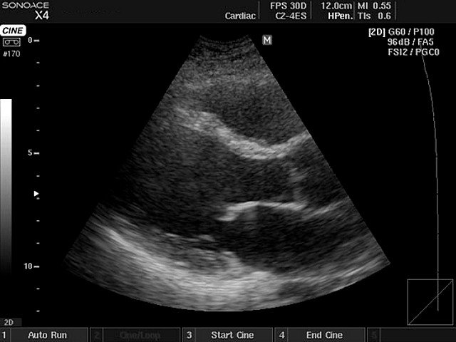 Heart, B-mode (echogramm №405)