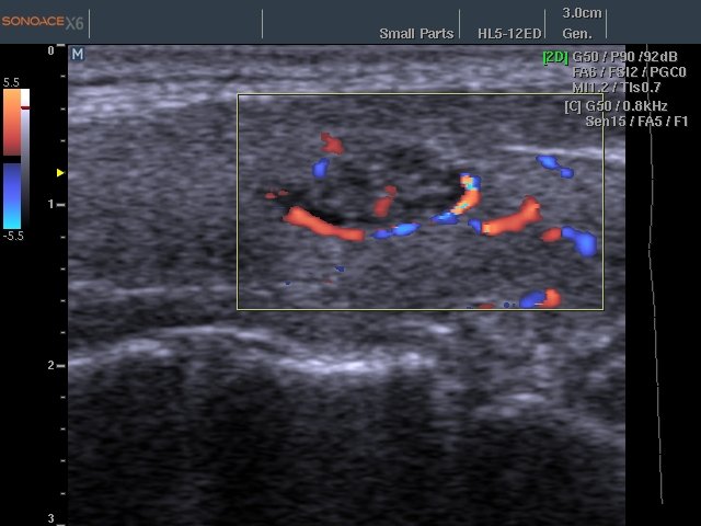 Обучение узи ultrasonicthyroid ru