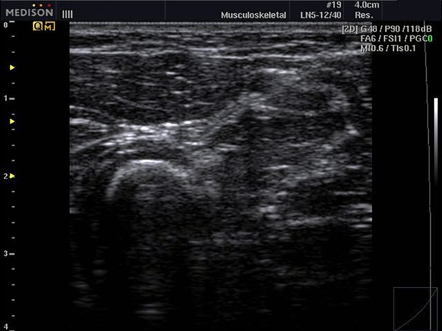 Soft tissue, Quick-FSI (echogramm №488)