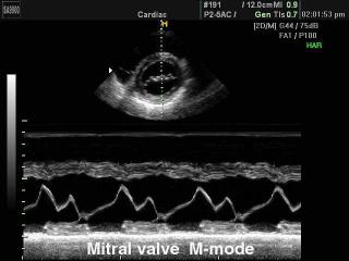 Mitral valve, M-mode