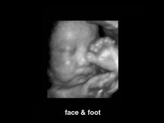 Fetal face and foot, 3D