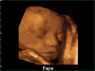 Fetal face, 3D