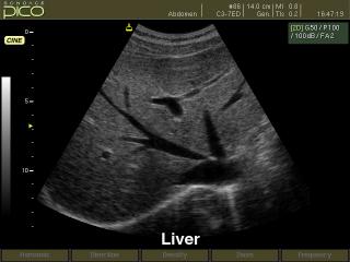 Liver, B-mode