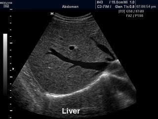 Liver, B-mode