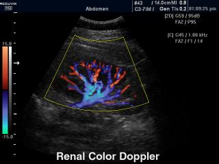 Kidney, color doppler