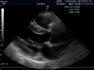 Heart - tissue harmonic, B-mode