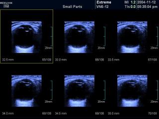 Orbit, MSV